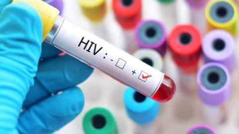 İnsan Bağışıklık Yetmezliği Virüsü (HIV) üzerine Bir Öğrenim Yolu