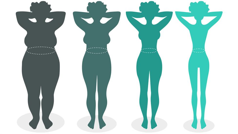 Obezite Cerrahisini Keşfedin: Obezite Cerrahisi Hakkında Sıkça Sorulan Sorular